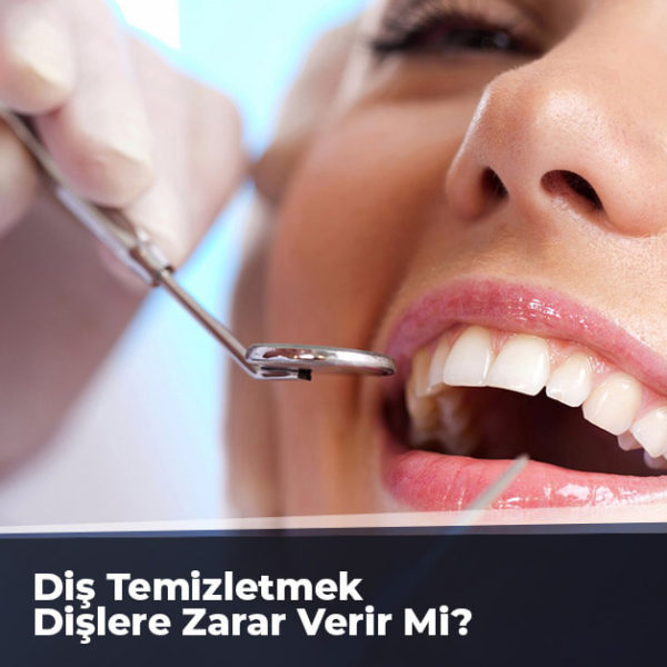 Diş Temizletmek Dişlere Zarar Verir Mi?