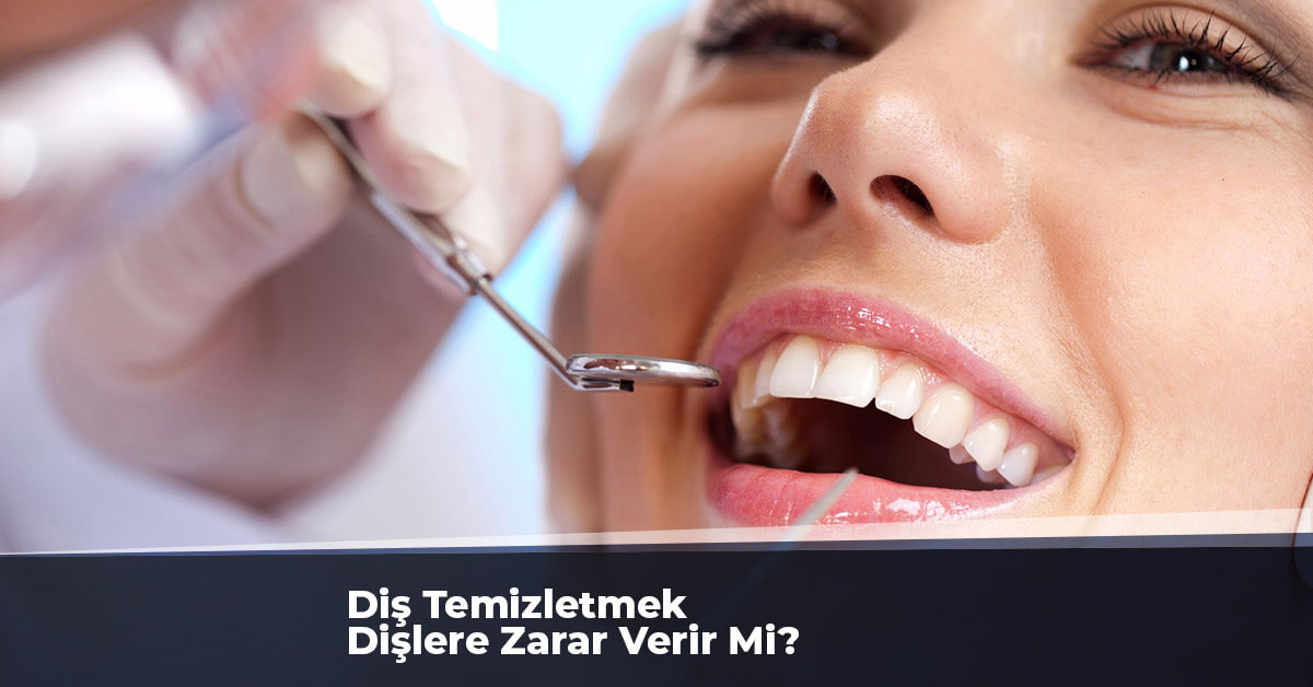 Diş Temizletmek Dişlere Zarar Verir Mi?