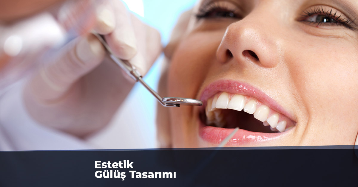 Estetik Gülüş Tasarımı