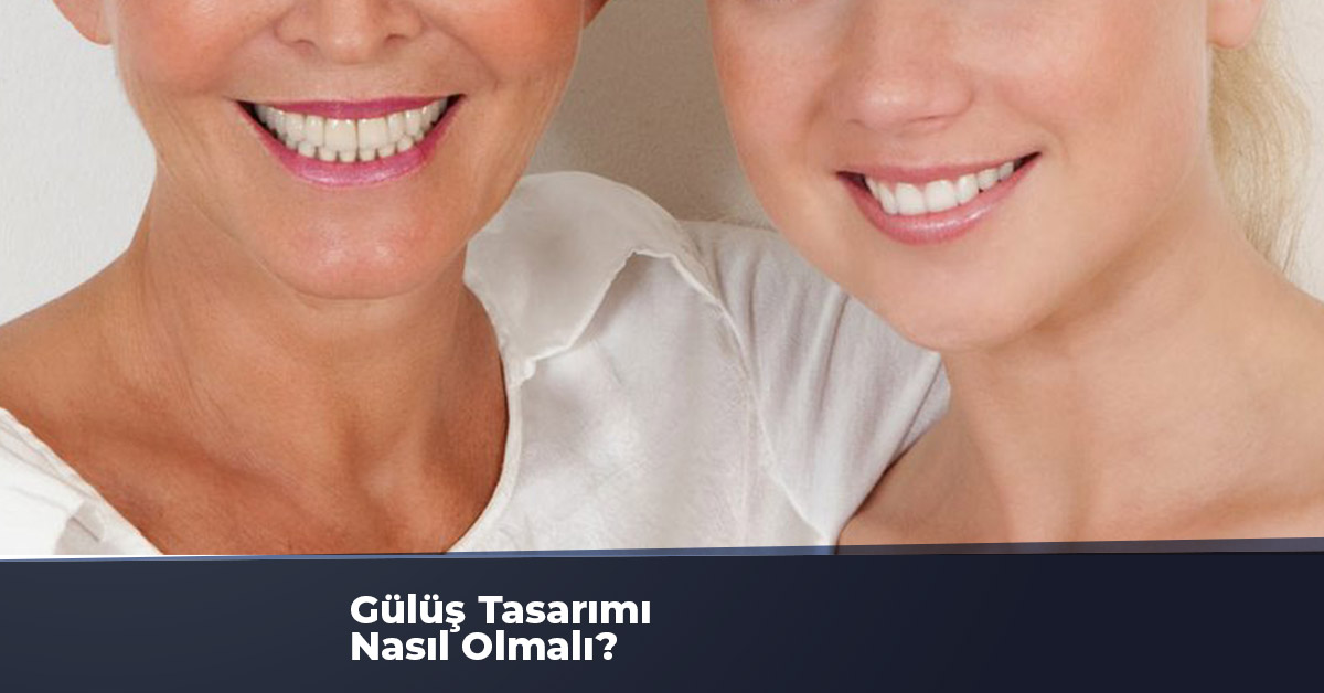 Gülüş Tasarımı Nasıl Olmalı?