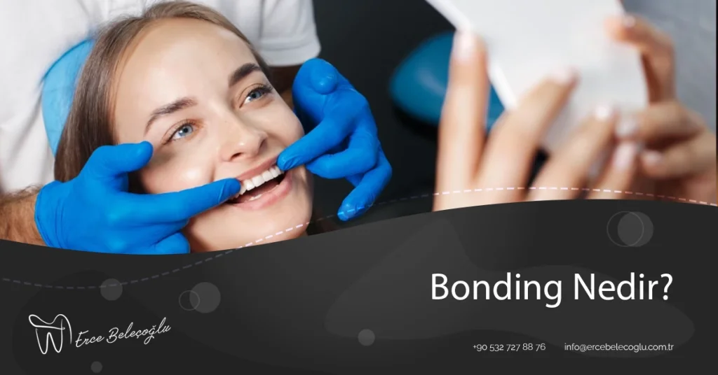 bonding-nedir