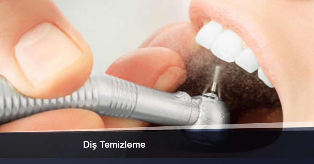 Diş Temizleme Ankara