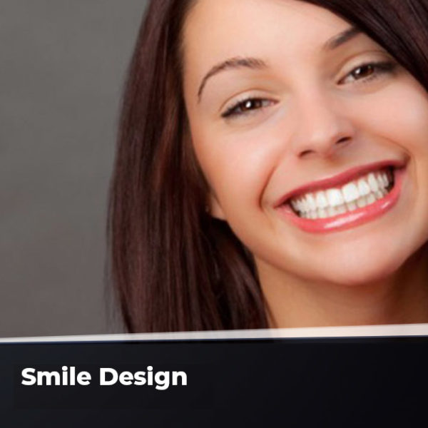Smile Design Ankara