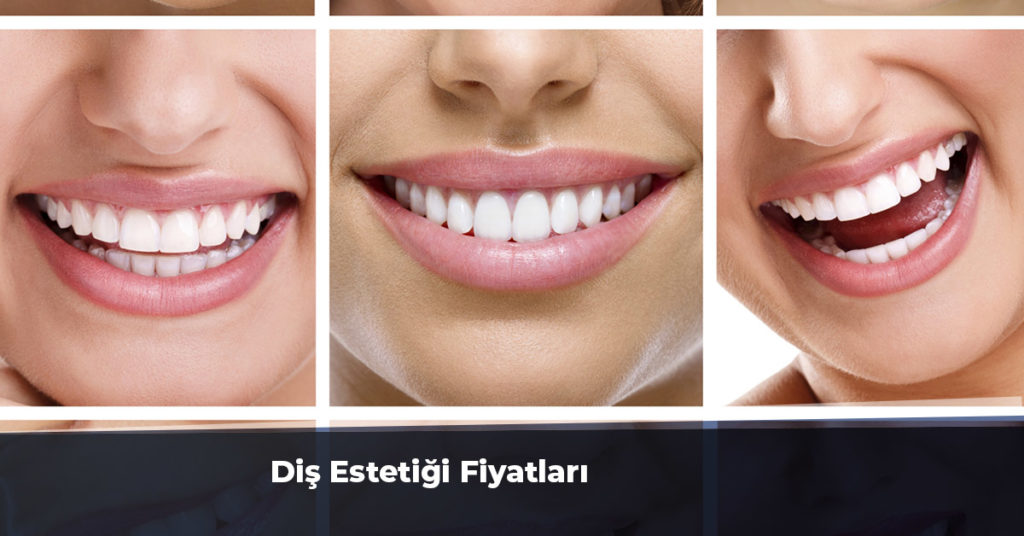 Diş Estetiği Fiyatları 2019