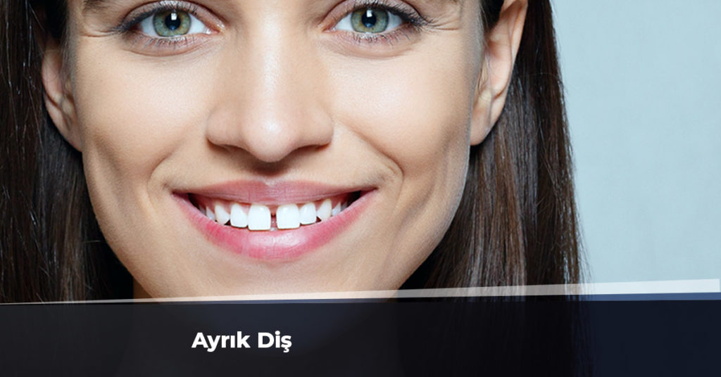 ayrık diş