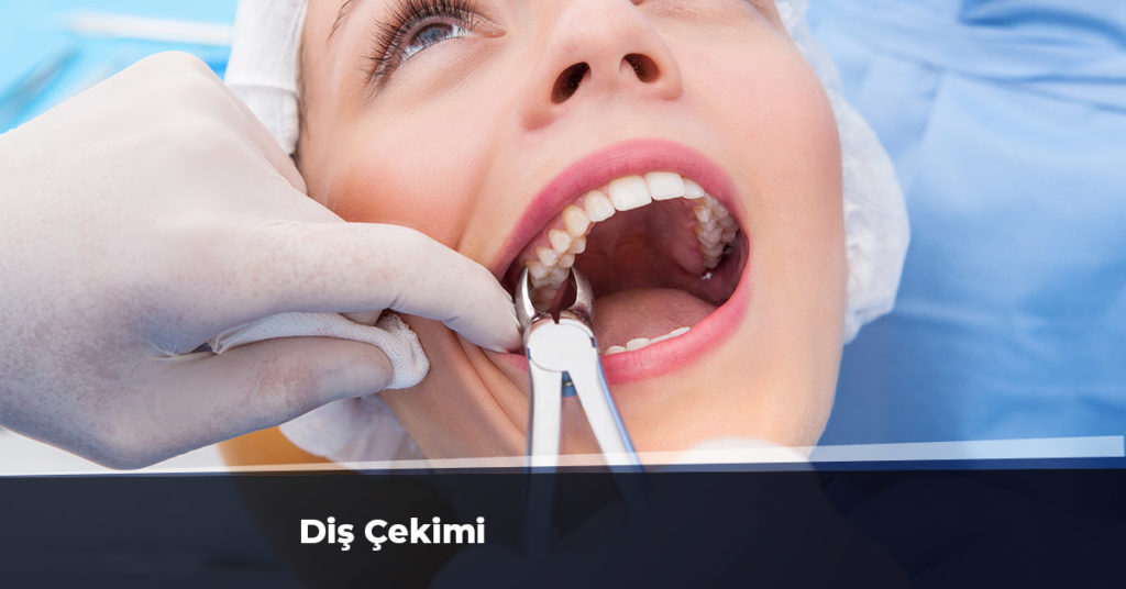 diş çekimi