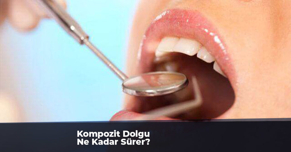 Kompozit Dolgu Ne Kadar Sürer?