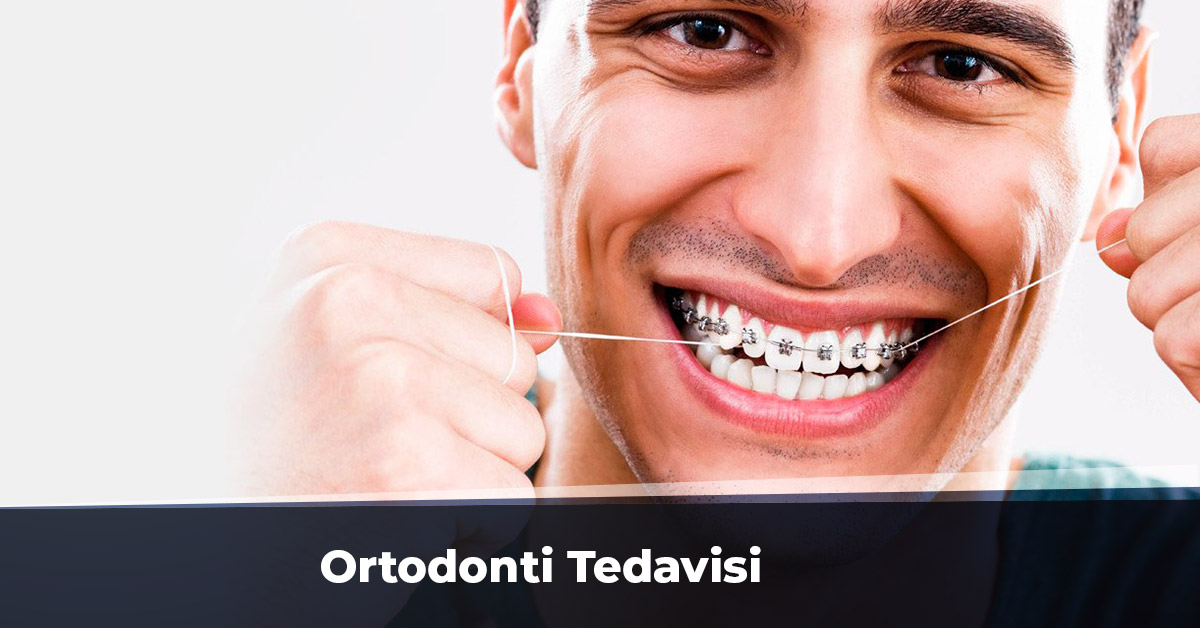 Ortodonti tedavisi fiyatları