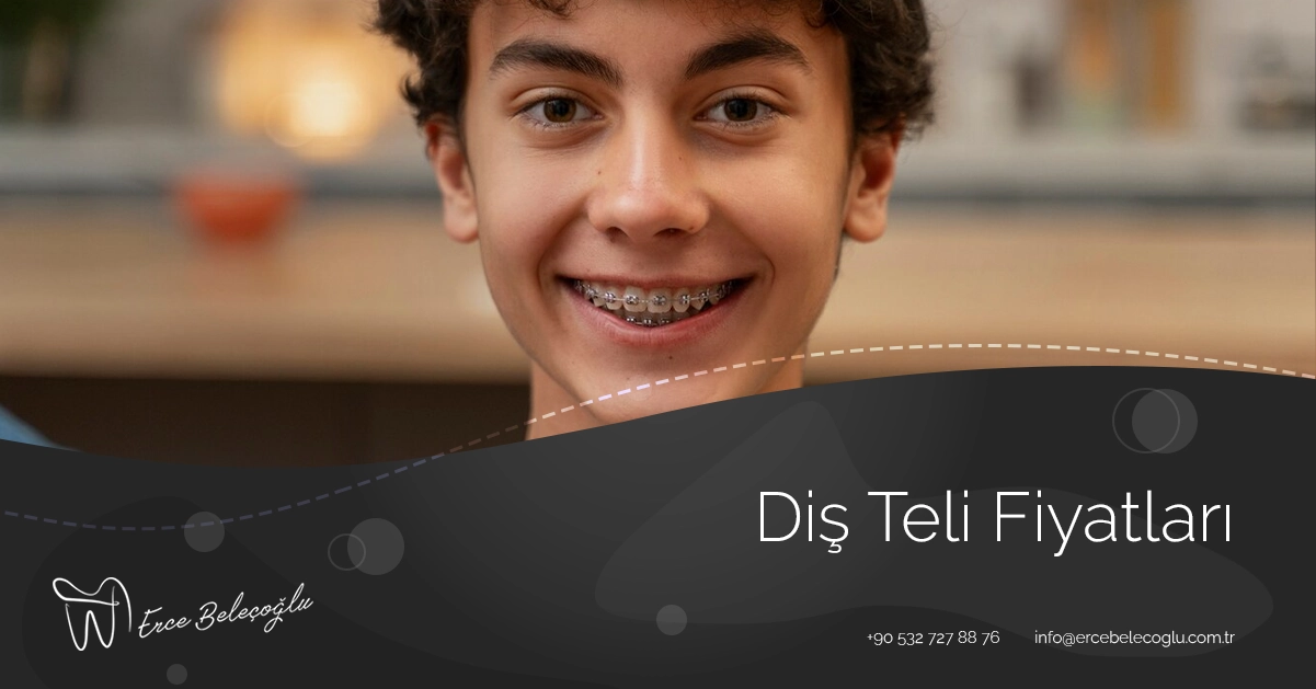Diş Teli Fiyatları