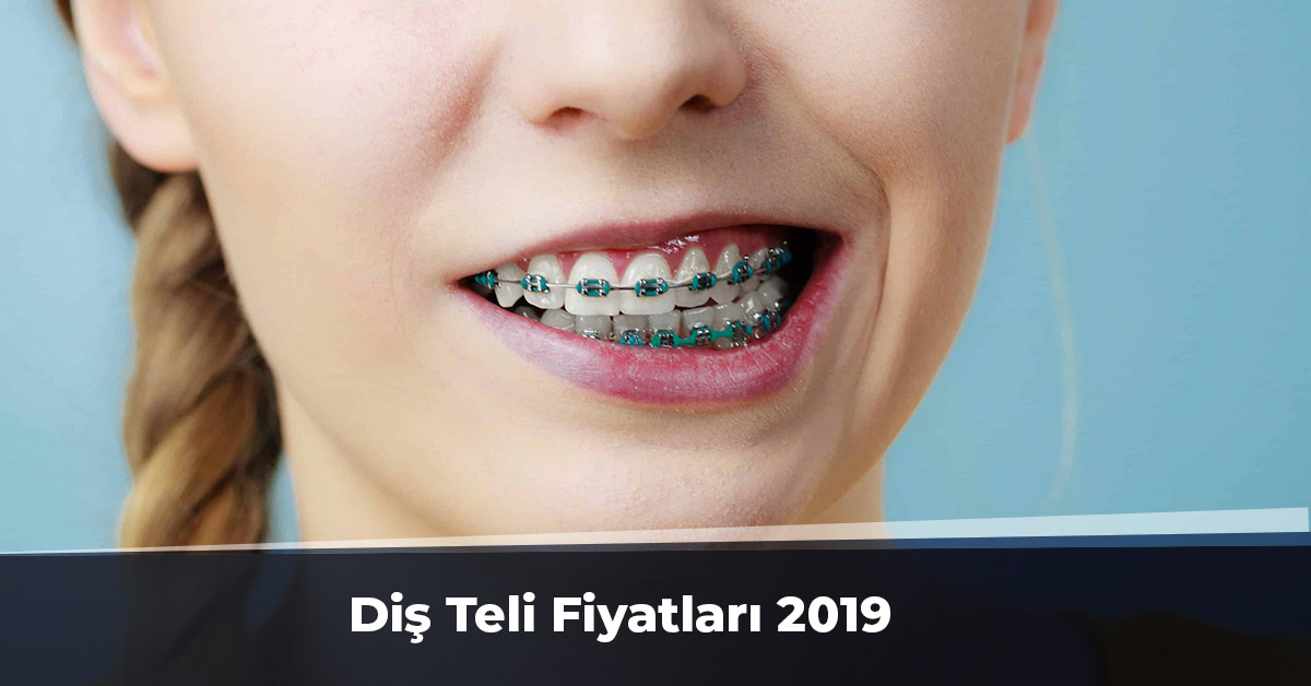 Diş teli fiyatları 2019