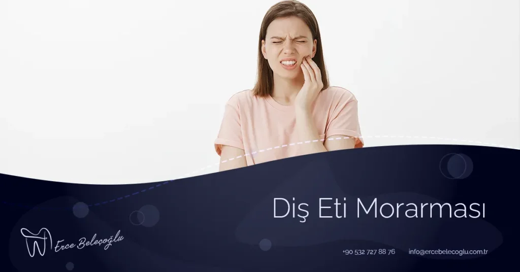 Diş Eti Morarması