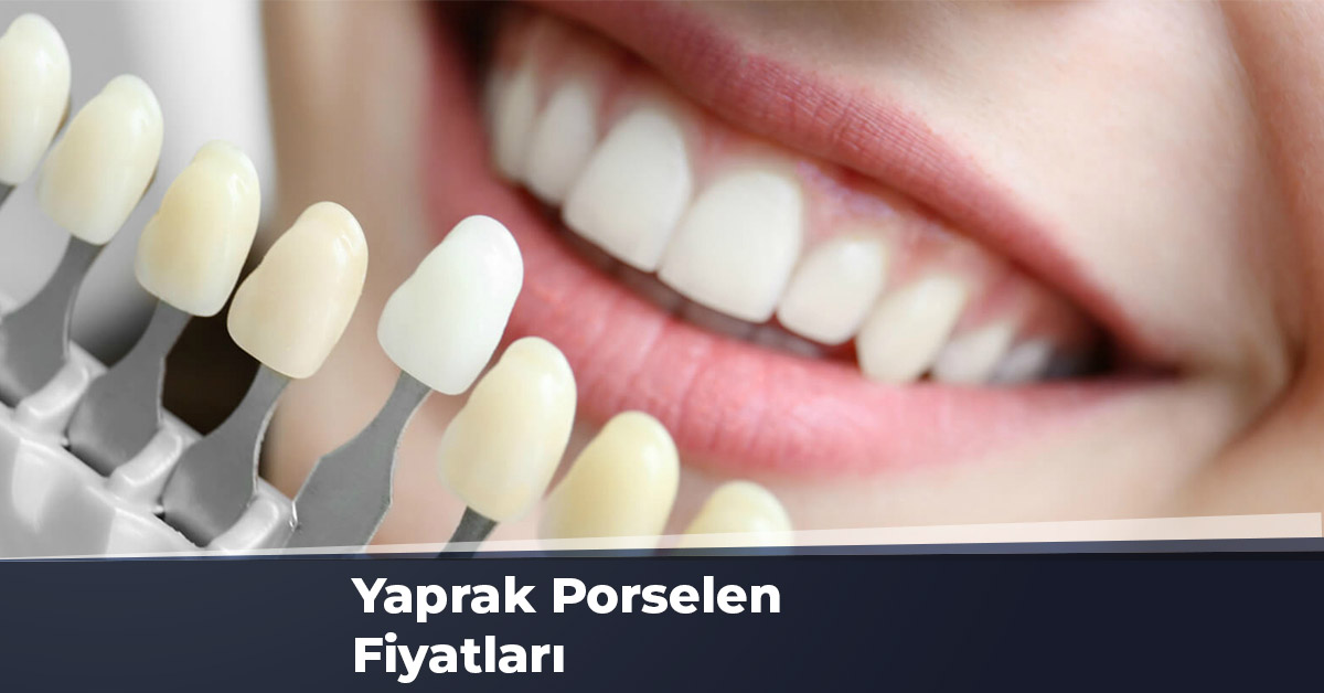 Yaprak Porselen Fiyatları Ankara