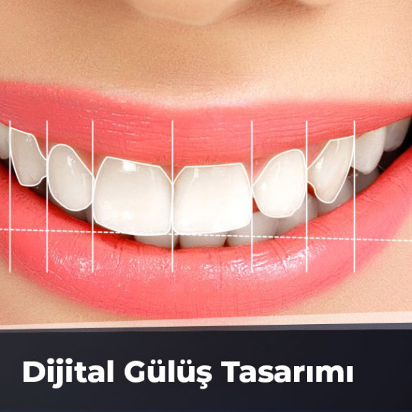 diş eti morarması