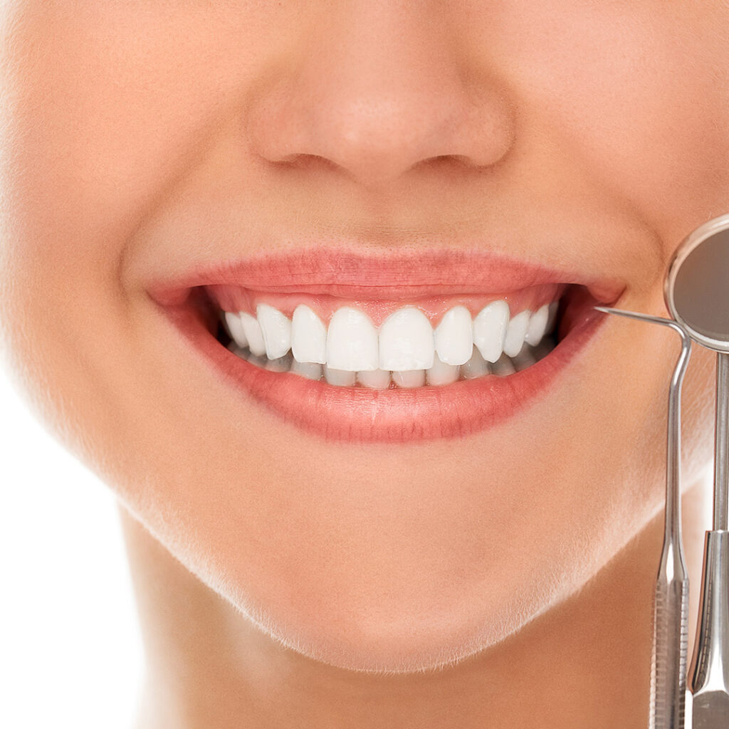 Ankara Diş Estetiği