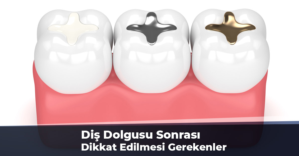 Diş Dolgusu Sonrası Dikkat Edilmesi Gerekenler