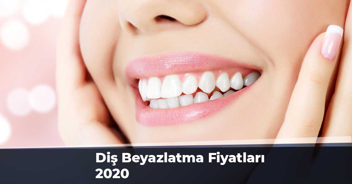 Diş Beyazlatma Fiyatları 2020