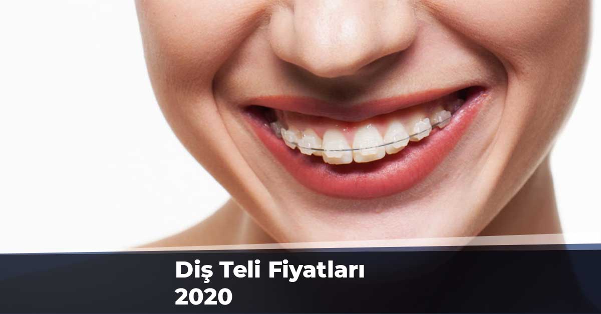 Diş Teli Fiyatları 2020