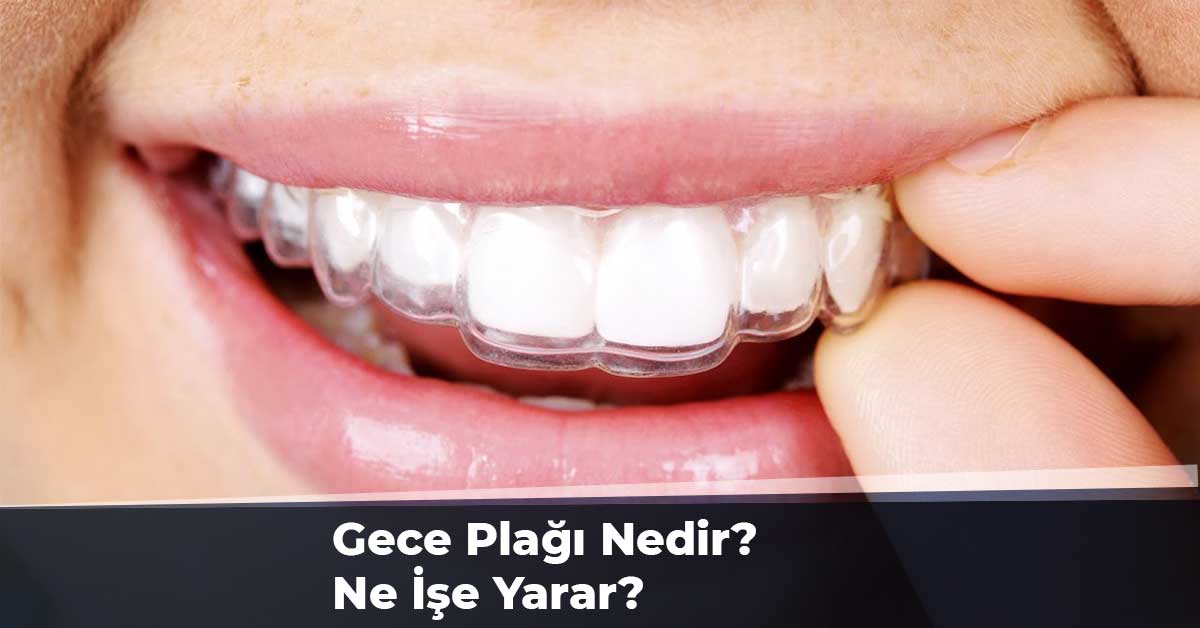 Gece Plağı Nedir?