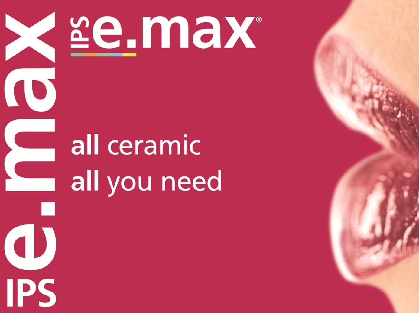 e-Max ile Diş Tasarımı