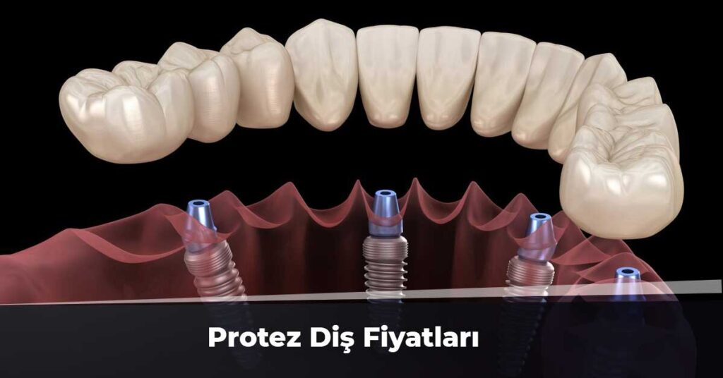 Protez Diş Fiyatları