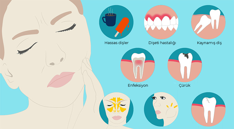 Şiddetli Diş Ağrısı Nedenleri