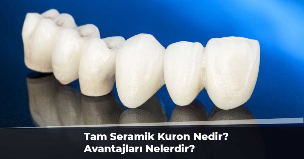 Tam Seramik Kuron Nedir? Avantajları Nelerdir?