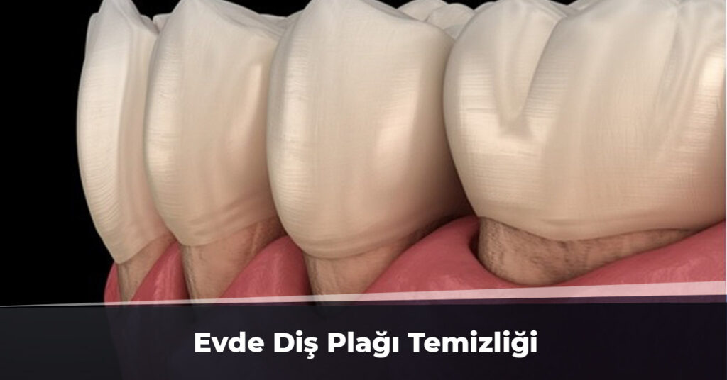 Evde Diş Plağı Temizliği