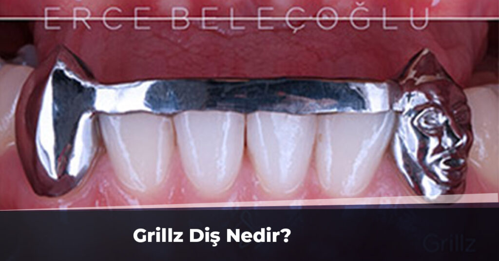 Grillz Diş Nedir?