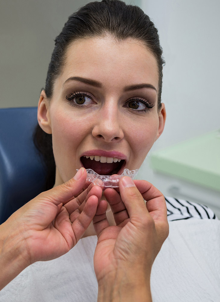 Invisalign Ankara (Telsiz Ortodonti) Nedir?
