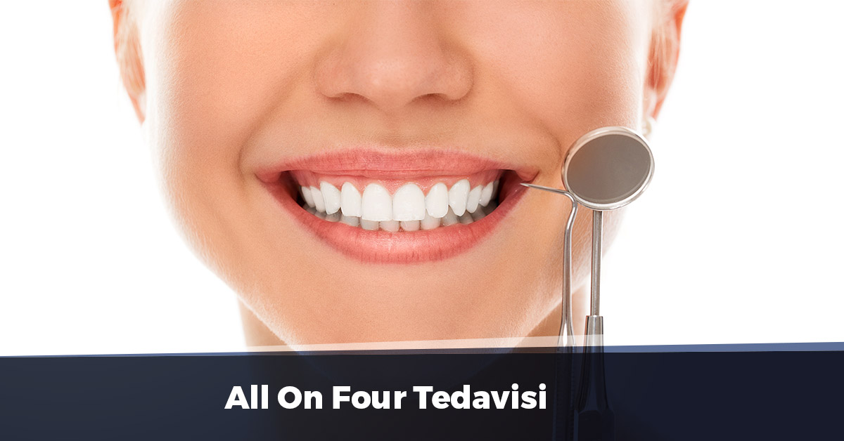 All On Four Tedavisi