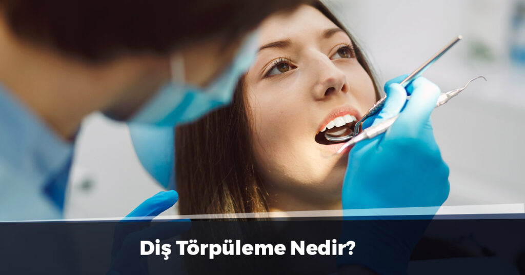 Diş Törpüleme Nedir?