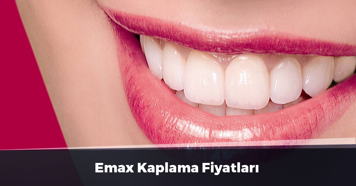 Emax Kaplama Fiyatları