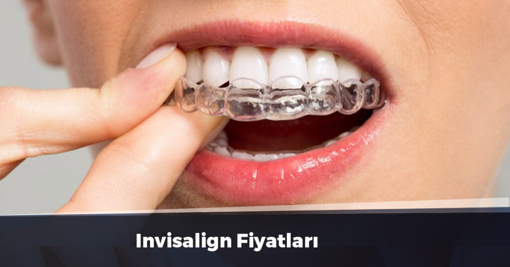 Invisalign Fiyatları