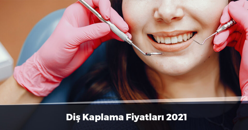 Diş Kaplama Fiyatları 2021