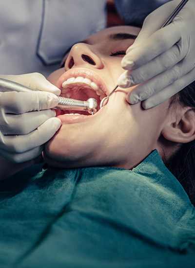 Amalgam Dolgu Değişimi Nasıl Yapılır?