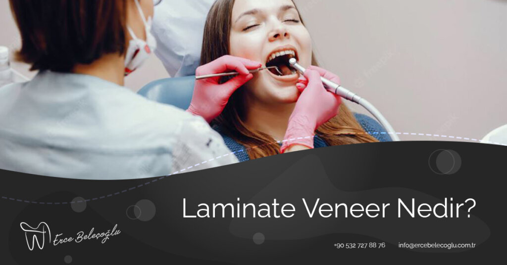 Laminate Veneer Nedir?
