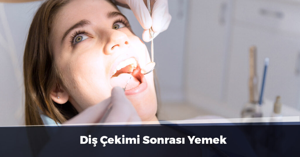 Diş Çekimi Sonrası Yemek