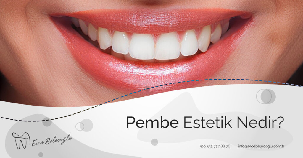 Pembe Estetik Nedir?