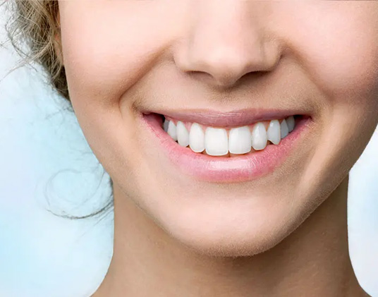 Dental Implants vs Veneers