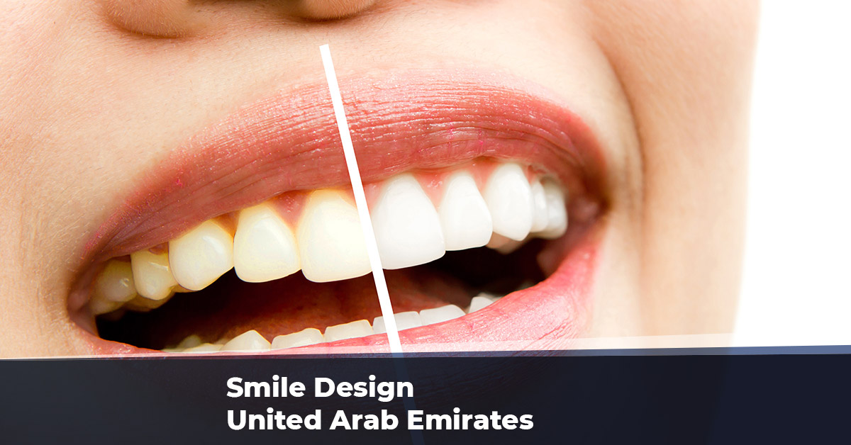 Smile Design United Arab Emirates