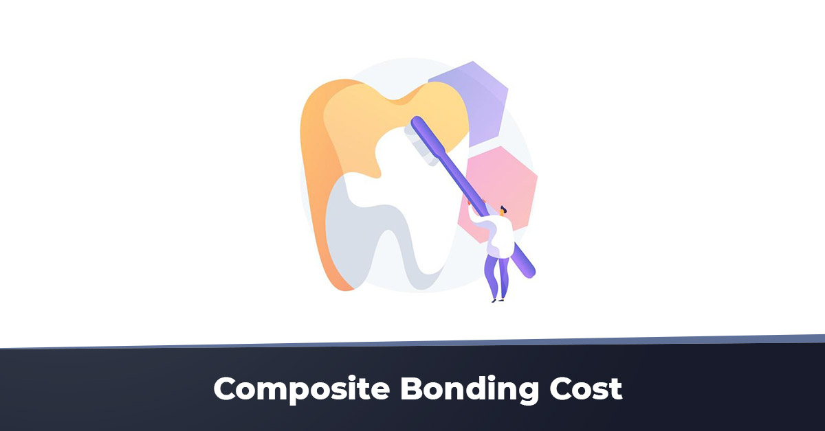 composite bonding cost
