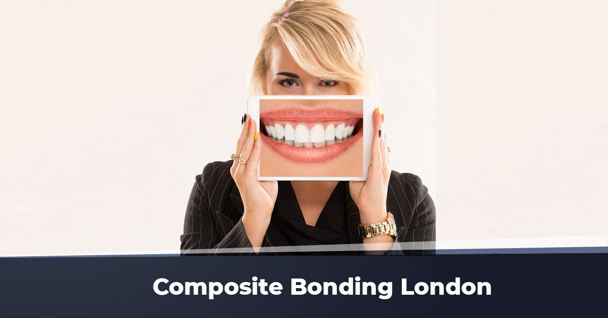 Composite Bonding London