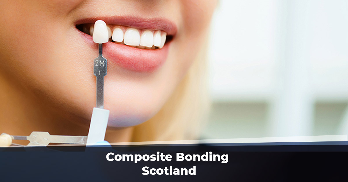 Composite Bonding Scotland