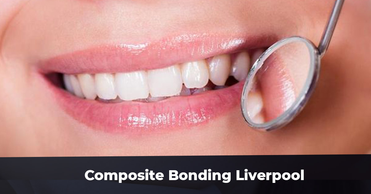 Composite Bonding Liverpool