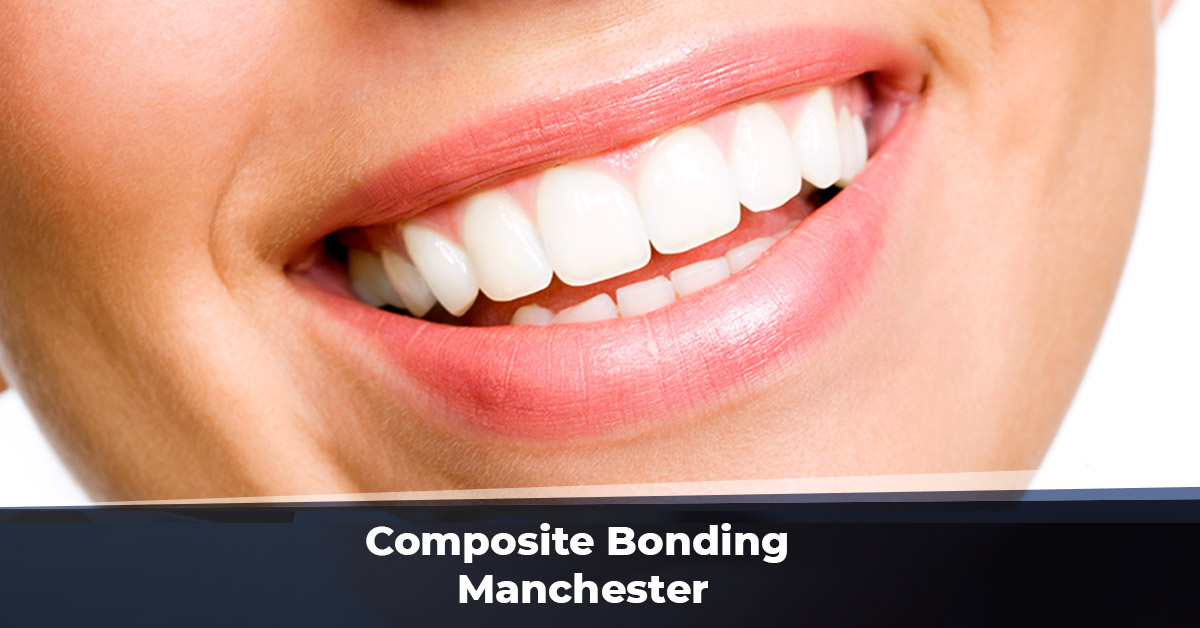 Composite Bonding Manchester