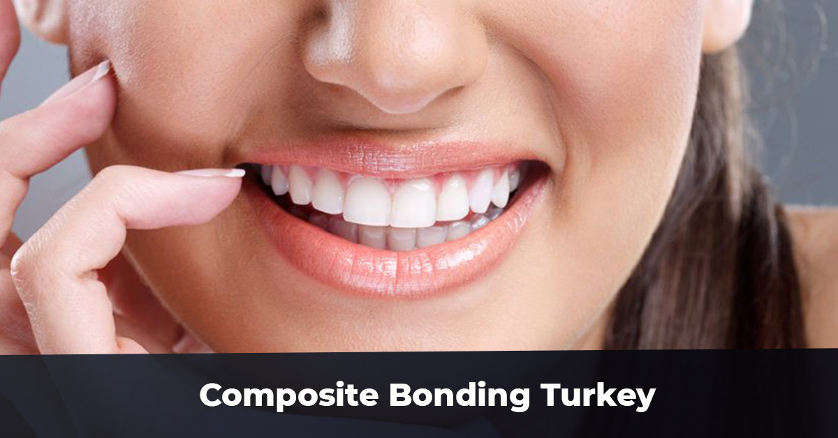 Composite Bonding Turkey