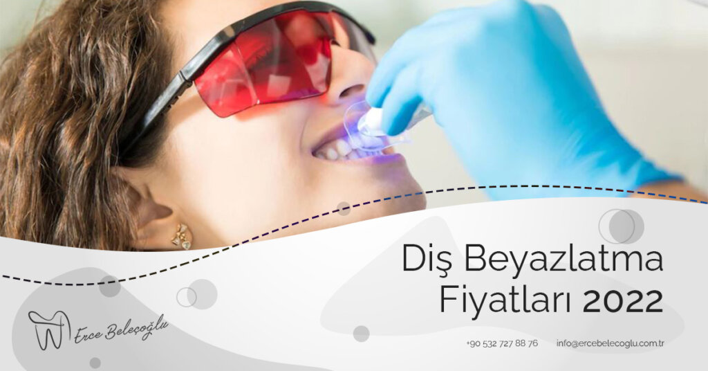 Diş Beyazlatma Fiyatları 2022