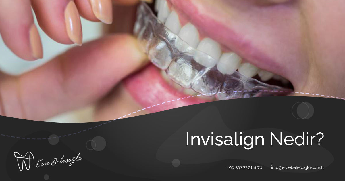 Invisalign Nedir?