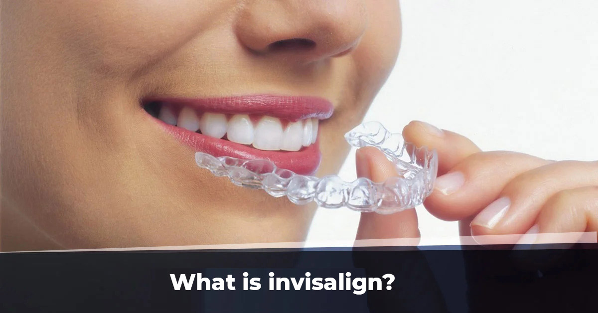 What is invisalign?