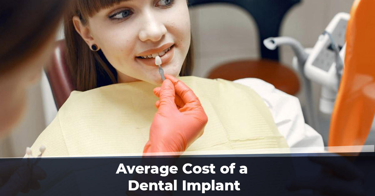 Average Cost of a Dental Implant